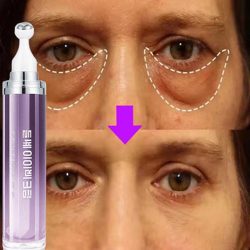 주름개선 아이크림 레티놀 리프팅 아이백 크림 20/30/40/50대여성 아이크림추천 콜라겐 병풀 900샷 아이크림 눈 밑 지방 볼륨 개선 히알루론산 여성 아이크림 추천 60대, 1개, 20ml 22,790원