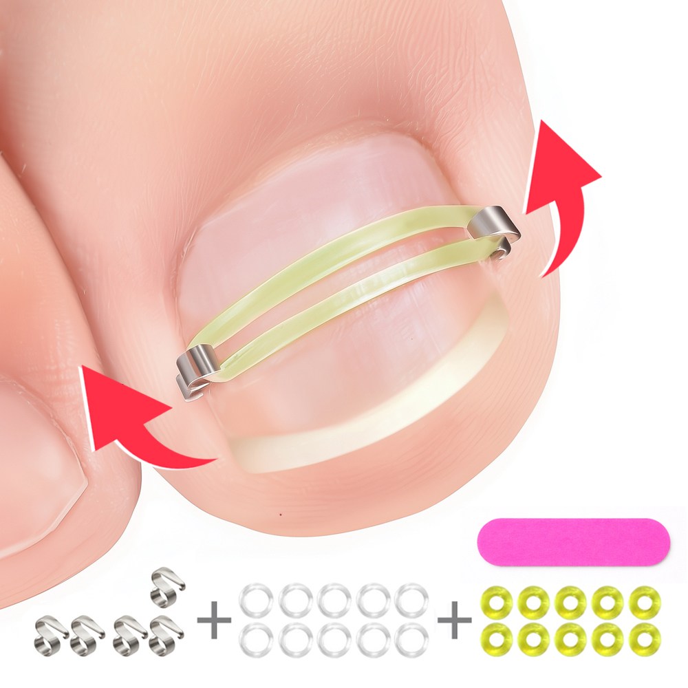 인생필품_설치쉬운 내성발톱 보호대_양발사용 수량+여분 팁1개, 1세트 22,800원