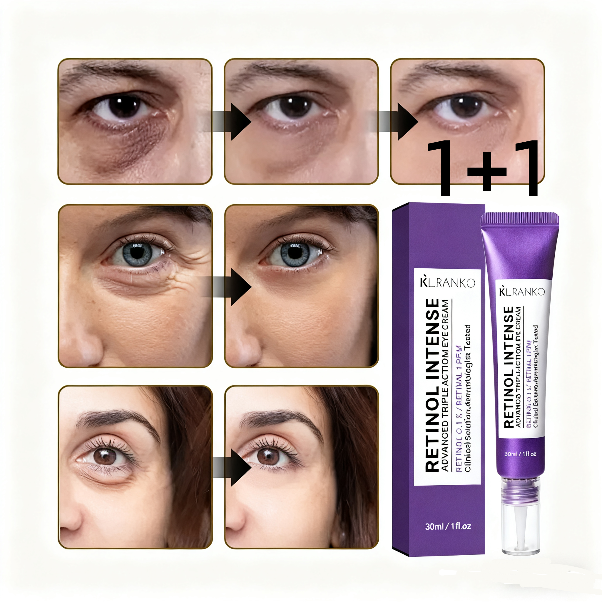 아이백 리프트 1100샷 리들 패치 리프팅 900 아이크림 눈 밑 지방 제거 크림 눈밑지방 아이백, 2개, 30g 30,800원