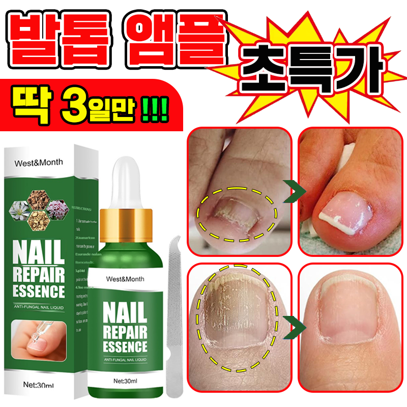 [국내배송] 발톱 거품나는앰플 솔루션 문제성발톱 앰플 발톱 곰팡이 한번에끝내는 손발톱 영양제 보장증정 12,900원