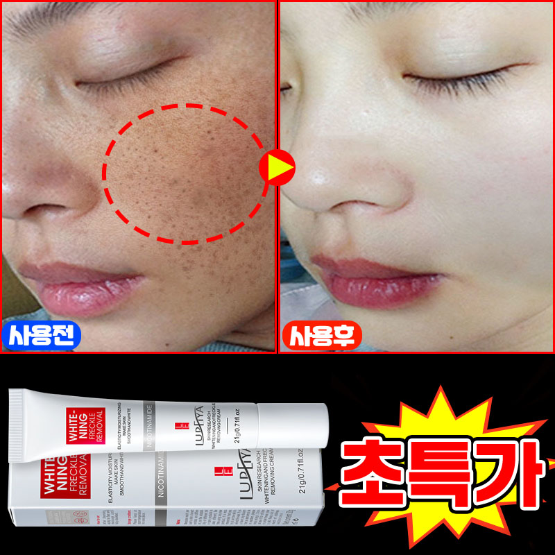 [100% 효과있음] 멜라논 크림 기미크림 기미 잡티 주근깨 검버섯 제거 크림 착색 미백 크림 들깨기미크림 색소침착 화이트닝 LUPEIYA 포장증정 11,600원