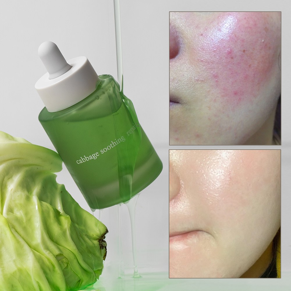 엘리메르 캐비지 수딩 리페어 세럼 에센스, 1개, 50ml 28,550원