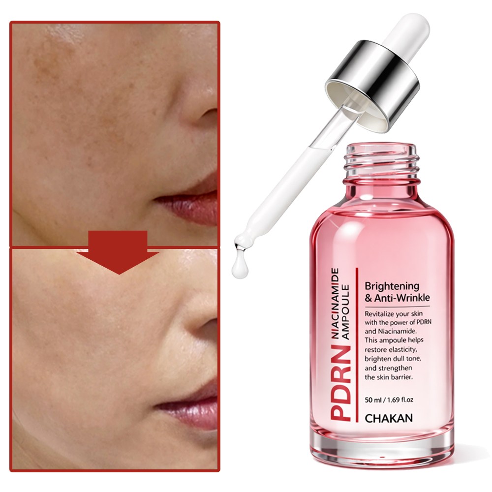 기미 잡티 주근깨 보습 모공 피디알엔 PDRN 나이아신아마이드 앰플, 1개, 50ml 19,500원