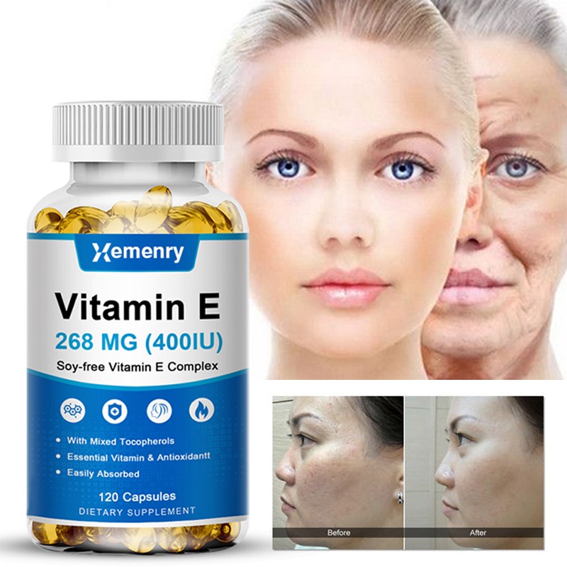 비타민 E 캡슐은 천연 항산화제로서 피부와 면역 체계를 지원하고 피부, 모발, 손톱, 면역력 및 눈 건강을 증진합니다. 10,940원