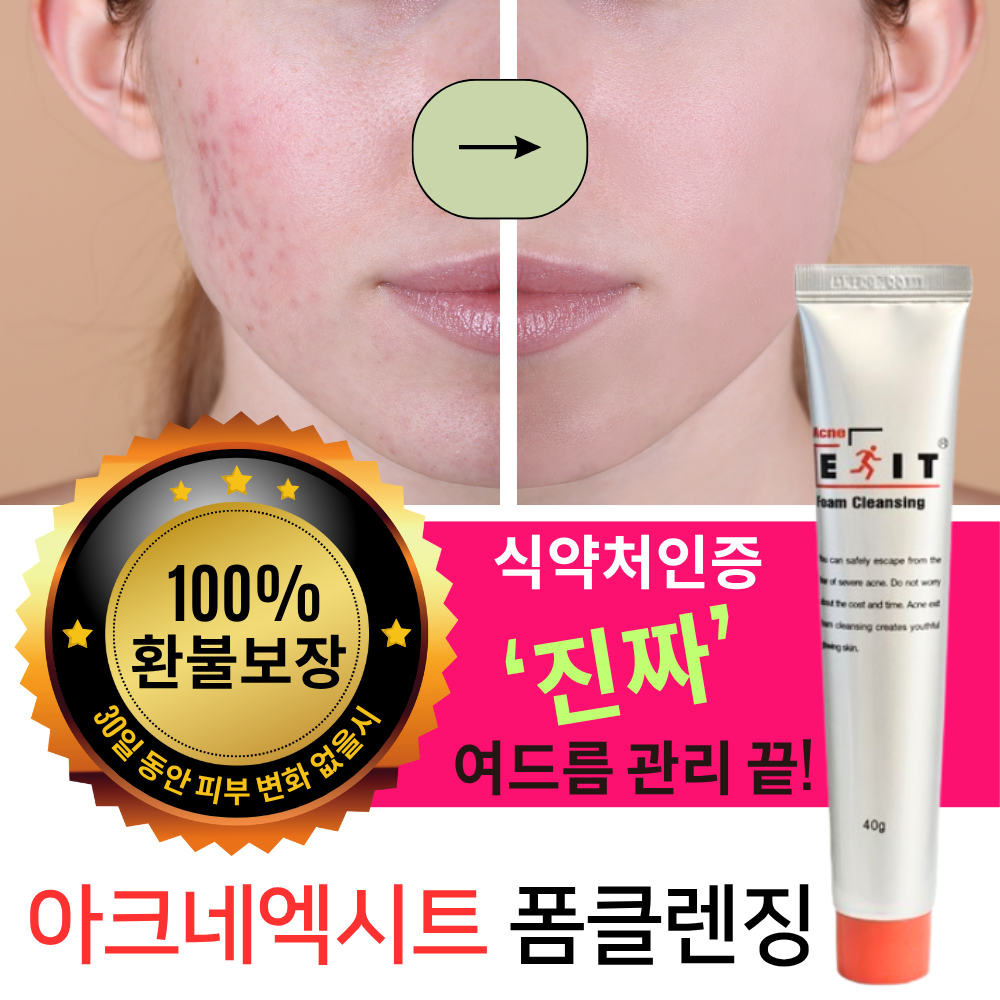 호야마트 청소년여드름세안제 얼굴트러블 폼클렌징, 1개, 40g 45,990원