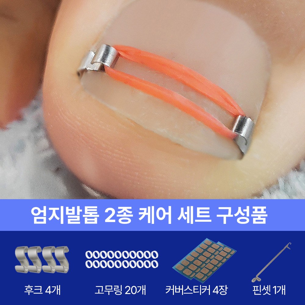 아임봄 파고드는 엄지발톱 압박을 덜어주는 케어템 26,400원