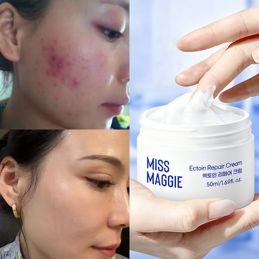 미스 매기 egf 자생크림 피부과 레이저시술 후 리페어크림 8,900원