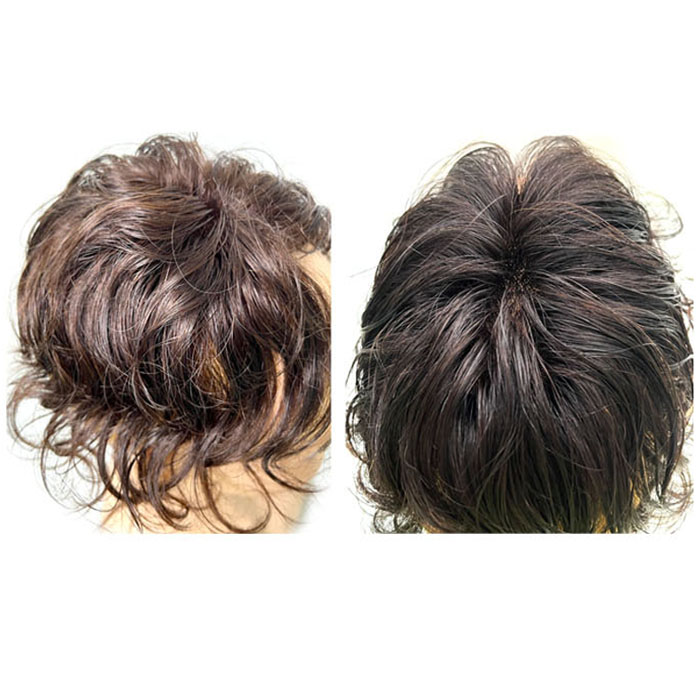 인모 파마머리 정수리 부분가발 (10x10) 정수리볼륨, 1개, 1.웨이브(10x10)-자연검정 105,000원