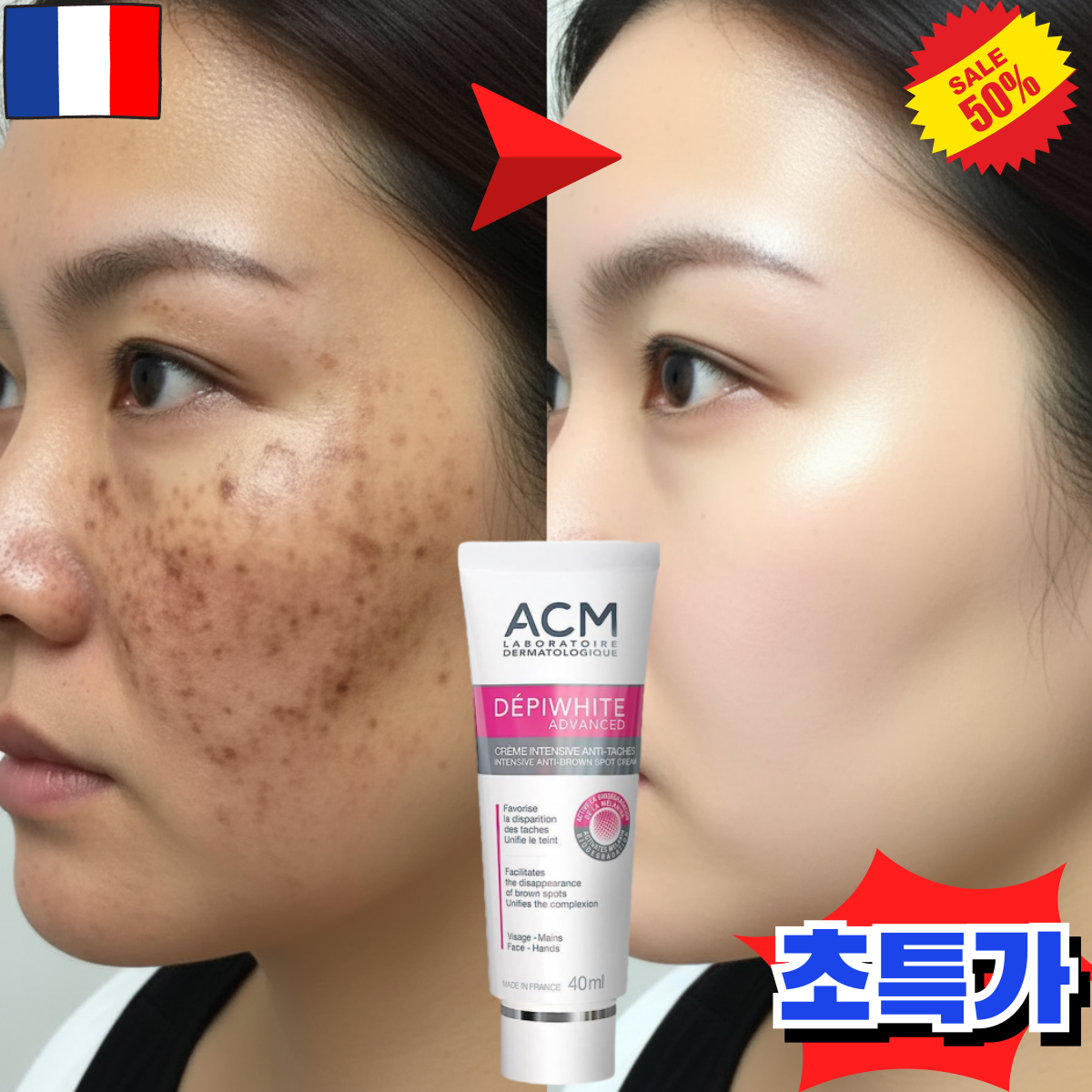 [프랑스 개발]멜라논 크림 기미 잡티 주근깨 검버섯 제거 크림 미백 크림 화이트닝 색소침착크림 13,500원