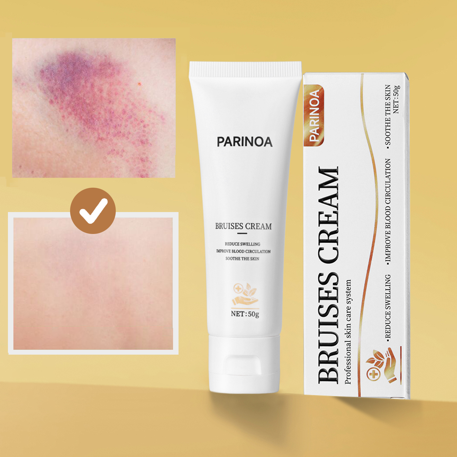 흔적 진정 멍 케어 크림 아르니카 멍 연고 리커버리 크림 멍 붓기완화 올인원, 1개, 50g 15,800원