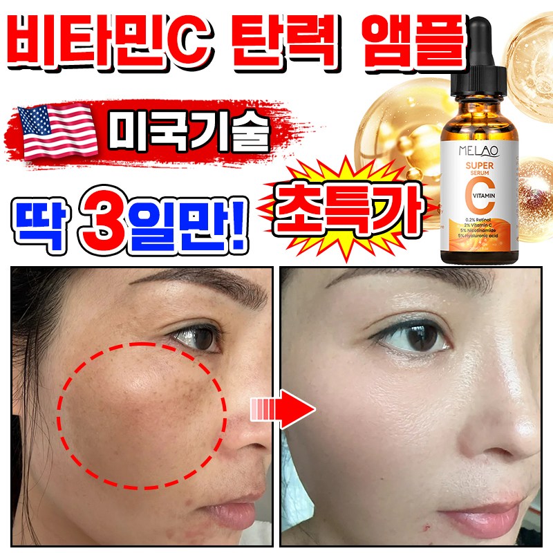 [100%제거] 1/1+1/2+2 비타민C 세럼 비타민 미백 앰플 기미 잡티 제거 에센스 비타씨플러스 잡티씨 탄력앰플 화이트닝 모공 수축 9,900원