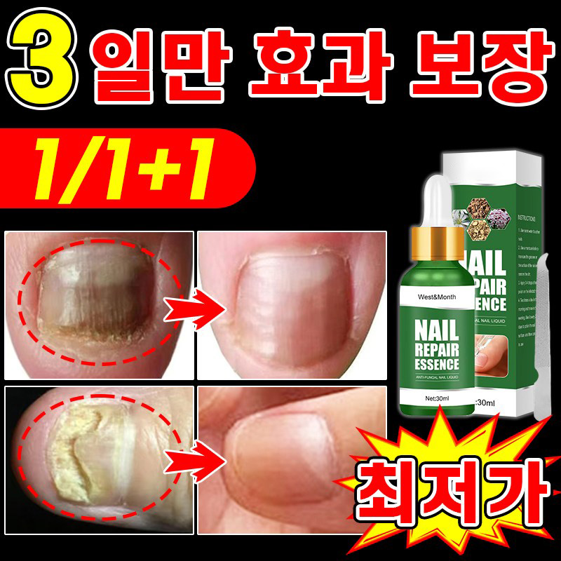 [국내배송] 솔루션 문제성발톱 앰플 발톱 곰팡이 한번에끝내는 손발톱 영양제 13,800원
