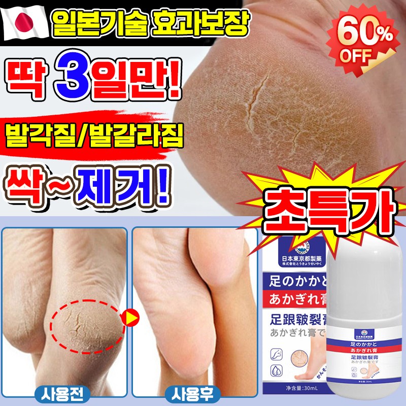 [고보습] 일본기술 1/1+1/2+2 풋크림 발각질제거 크림 풋케어 스틱 발크림 발뒤꿈치 굳은살 제거 발갈라짐 크림 10,800원