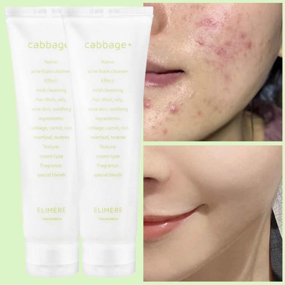 캐비지 여드름기능성 바하 약산성 폼클렌징, 120ml, 2개 31,010원