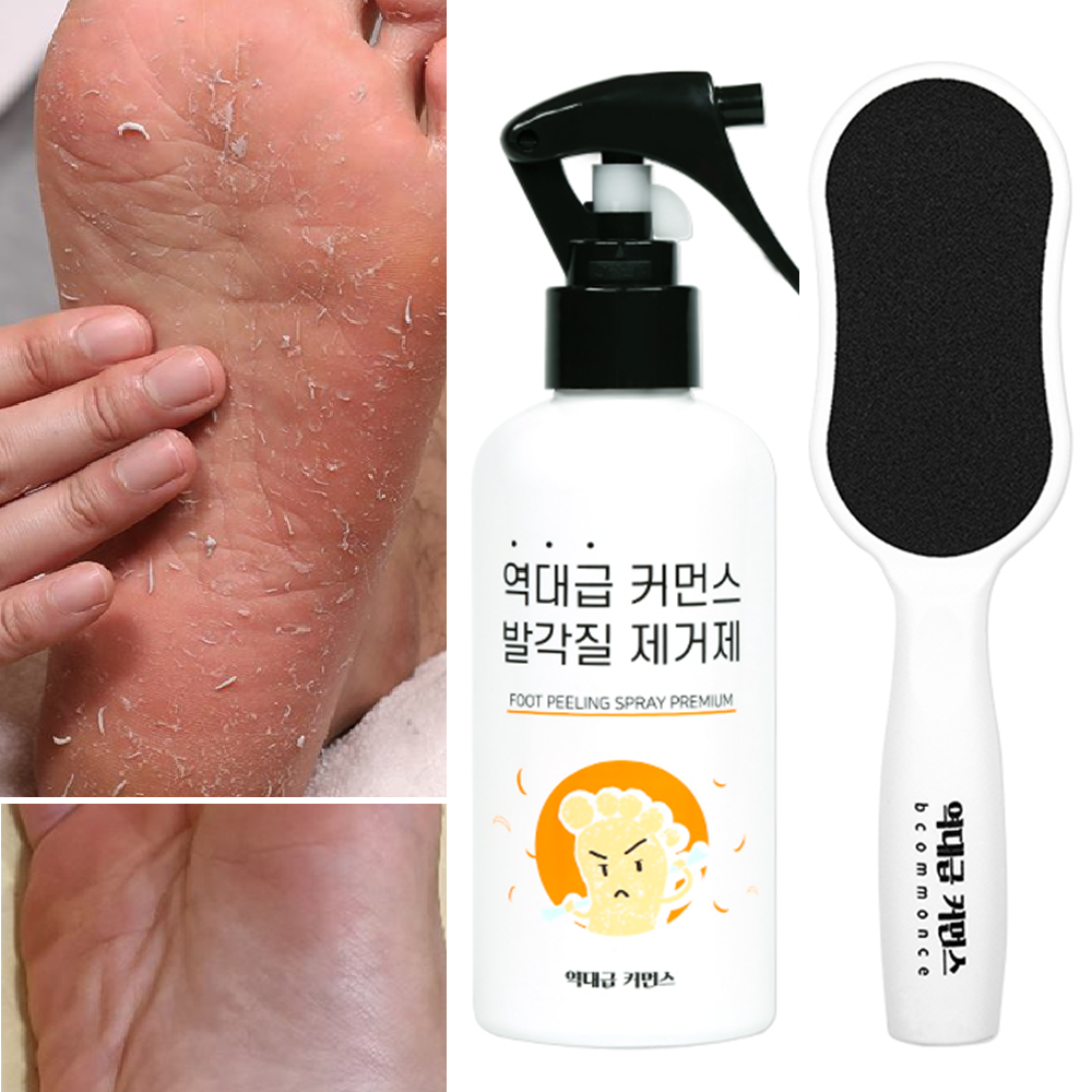 역대급커먼스 발각질 제거제+각질 제거기 풋파일 세트 (올리브영 입점 제품! 발바닥, 뒷꿈치 각질 제거! 연화제 성분 함유) 29,900원