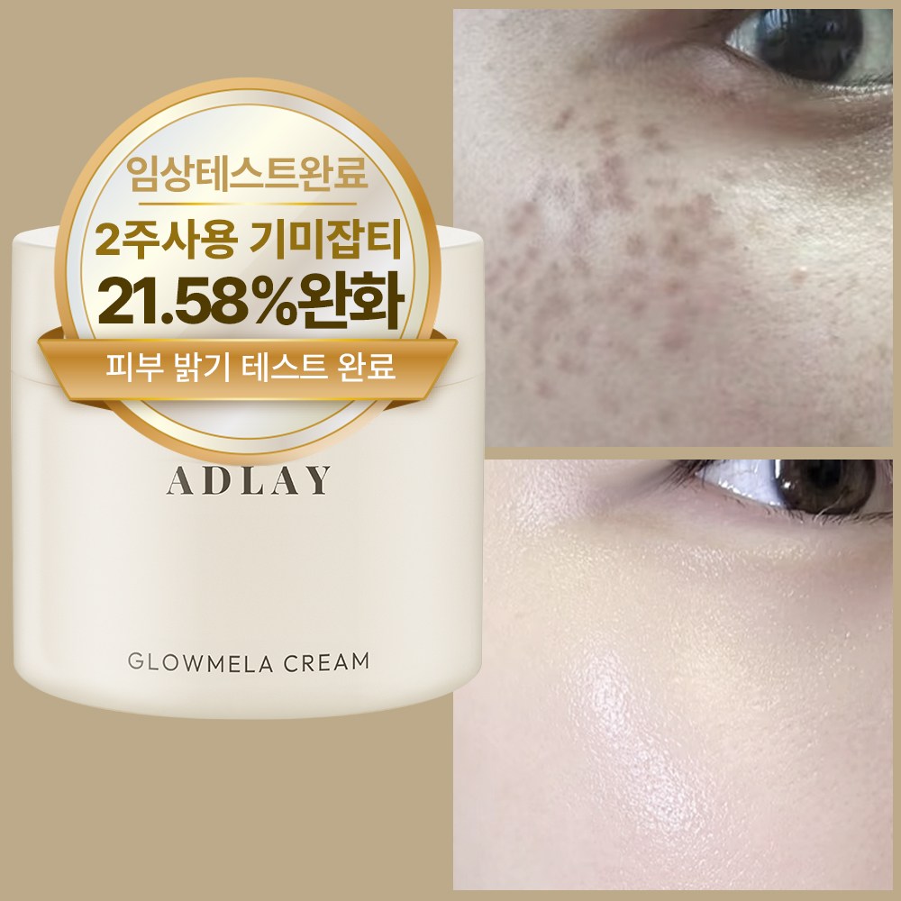 아들레이 화이트닝 색소침착 기미 주근깨 잡티 착색 미백크림, 1개, 70ml 21,550원