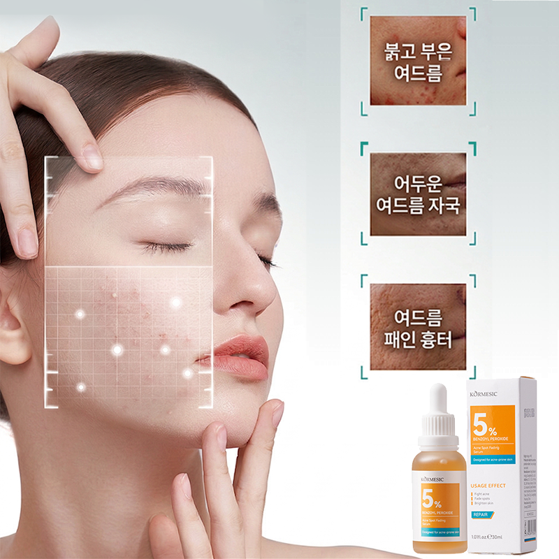 Gurene 5% 벤조일 퍼옥사이드 트러블 타겟팅 세럼, 2개, 30ml 18,400원