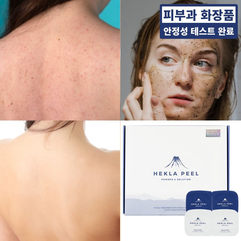 헤클라필 스피큘 해초 필링 세트 (피부과 알라딘필링 셀프 홈케어 / 깐달걀 피부 각질 제거 더마 케어 묵은각질 모공 등드름 가드름 피부결 박피 전문 제품), 1개, 9g 71,000원