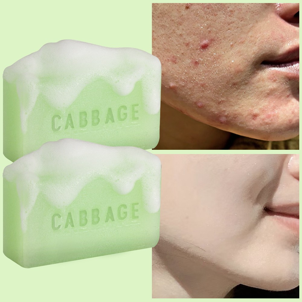 캐비지 약알칼리성클렌징폼 천연비누 대용량, 95g, 2개입 26,630원