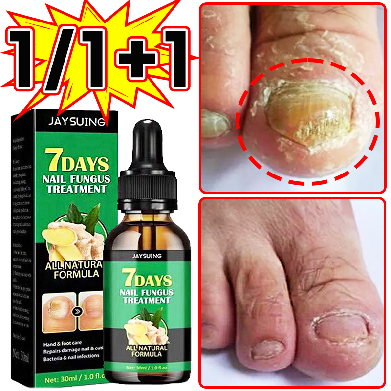 [국내배송] 발톱 앰플 문제성발톱 거품나는앰플 발톱 곰팡이 한번에 끝내는 손발톱 영양제 24,800원