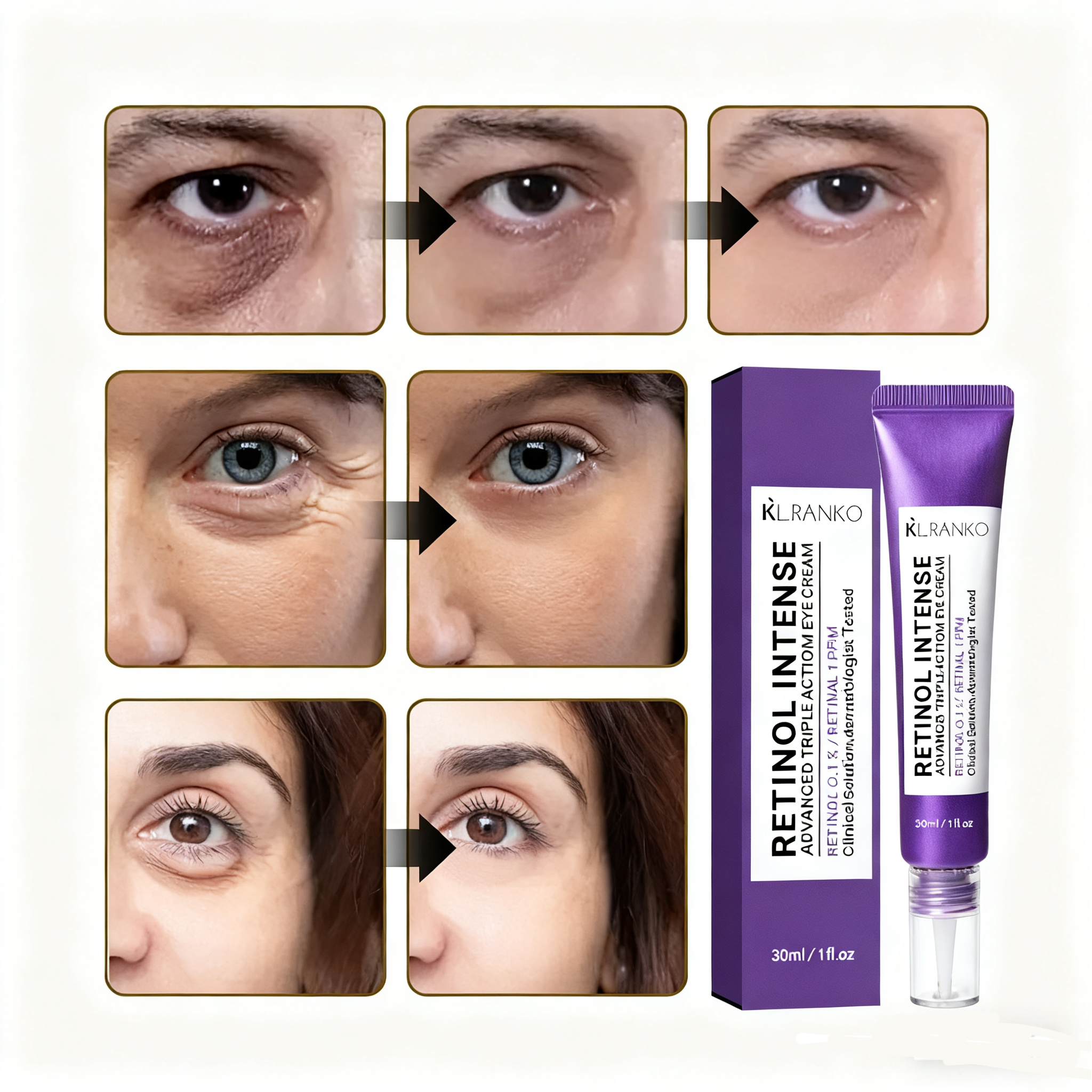 아이백 리프트 1100샷 리들 패치 리프팅 900 아이크림 눈 밑 지방 제거 크림 눈밑지방 아이백, 1개, 30g 20,800원