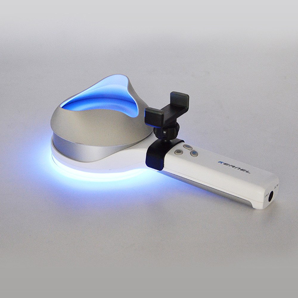아로 휴대용 LED UV돋보기 휴대폰 거치대 피부 검사 병원 정밀 관찰, 1개 620,000원