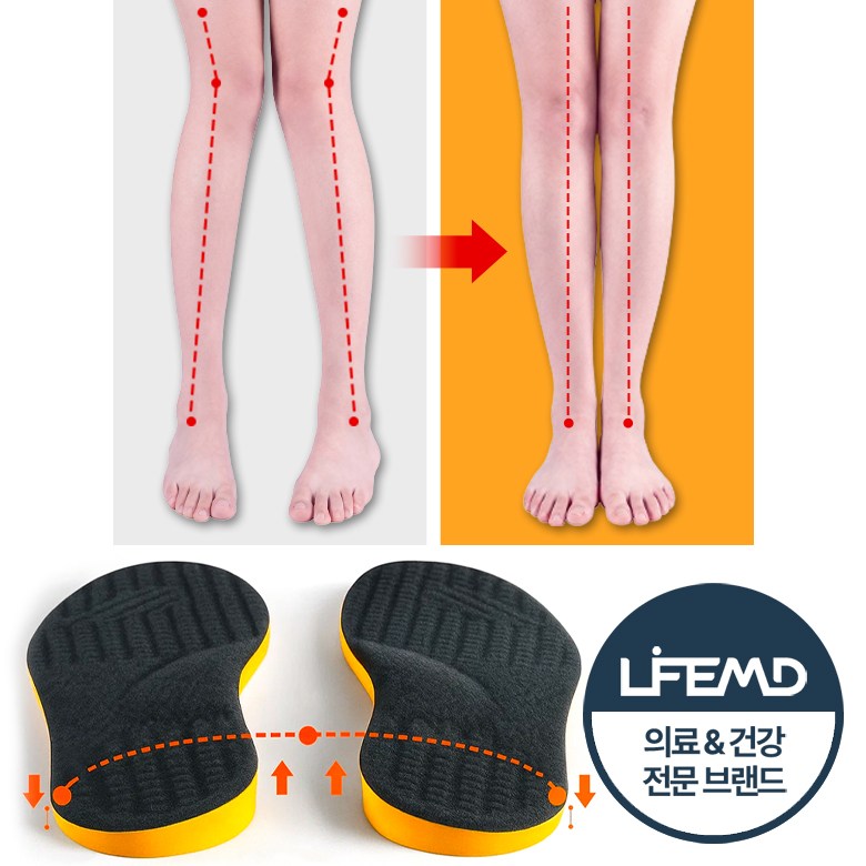 라이프엠디 휜다리 교정용 깔창 X자형 다리 평발 교정 기능성 인솔 아치 보조 쿠션 발편한 구름 메모리폼 패드 9,800원
