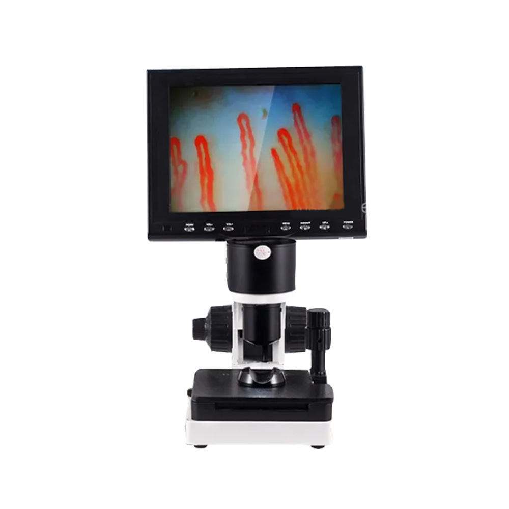 아로 혈류현미경 조갑주름모세혈관 관찰 혈관 혈액순환 1,000,000원