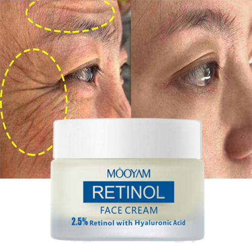 레티놀 크림 주름개선크림 모공수축크림 주름개선 비타민 A 크림 검버섯 제거, 50g, 1개 6,170원