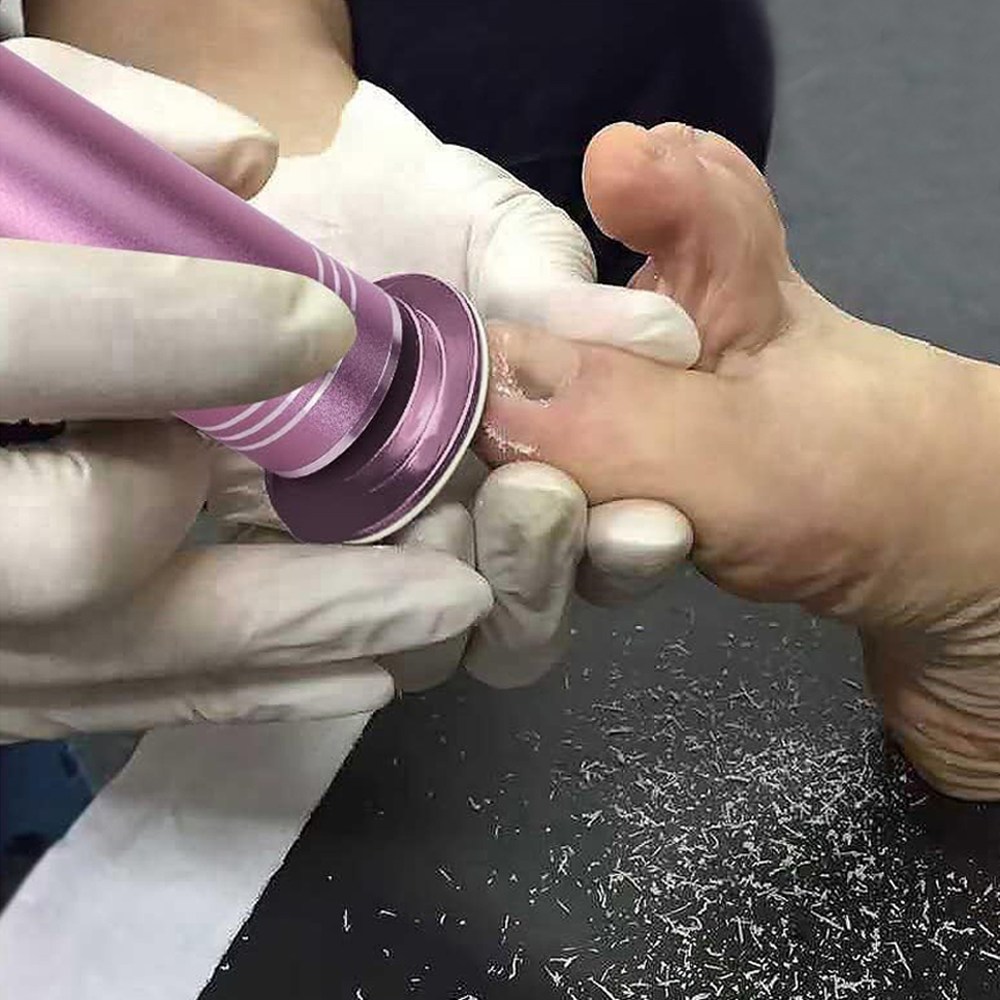 브랜드엘 전동 발각질제거기 뒤꿈치 각질제거기 굳은살제거 풋파일 24,130원