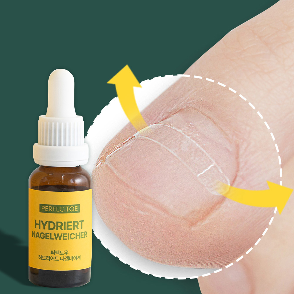 [2종 세트] 퍼펙토 내성발톱 교정기&발톱 연화제 자가치료 테이프 의료기기 세트, 10개 27,500원