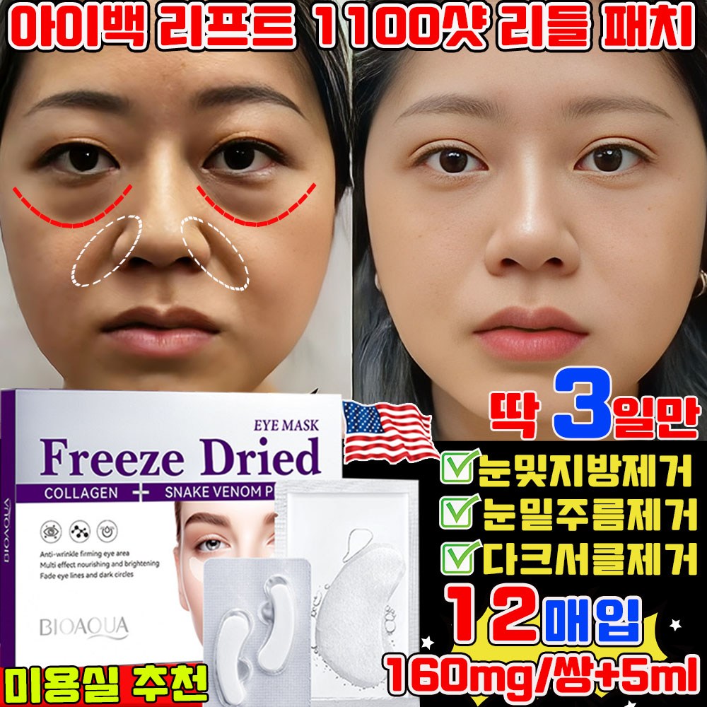 아이백 리프트 1100샷 리들 패치 눈밑 지방제거 패치 눈 밑 아이패치 니들 패치 눈밑주름 다크서클 눈밑꺼짐 개선 리프팅 패치 동결건조 아이백 사은품 랜덤 증정 18,900원