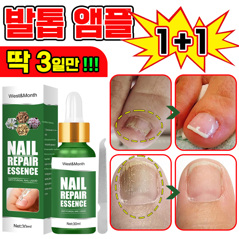 [국내배송] 발톱 거품나는앰플 솔루션 문제성발톱 앰플 발톱 곰팡이 한번에끝내는 손발톱 영양제 보장증정 15,900원
