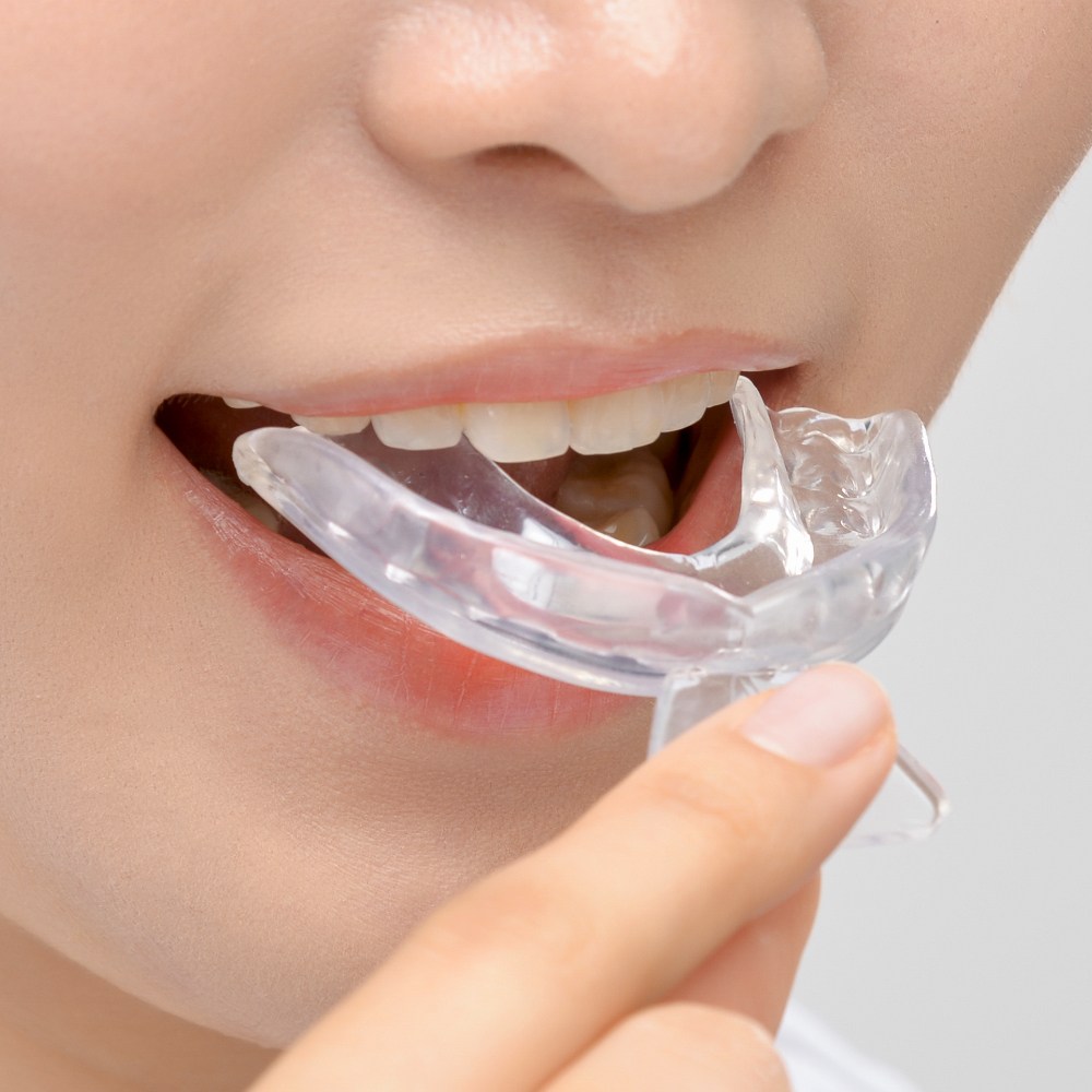 이갈이 마우스피스 수면용 스플린트 덴티미 클래식, 1개, 현재가 5,900원