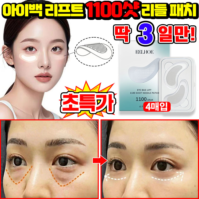 [100% 효과있음] 1/1+1/2+2 아이백 리프트 1100샷 리들 패치 눈밑 지방제거 아이 패치 다크서클 눈밑꺼짐 제거 아이팩 히알루론산 LUPEIYA 포장증정 13,800원