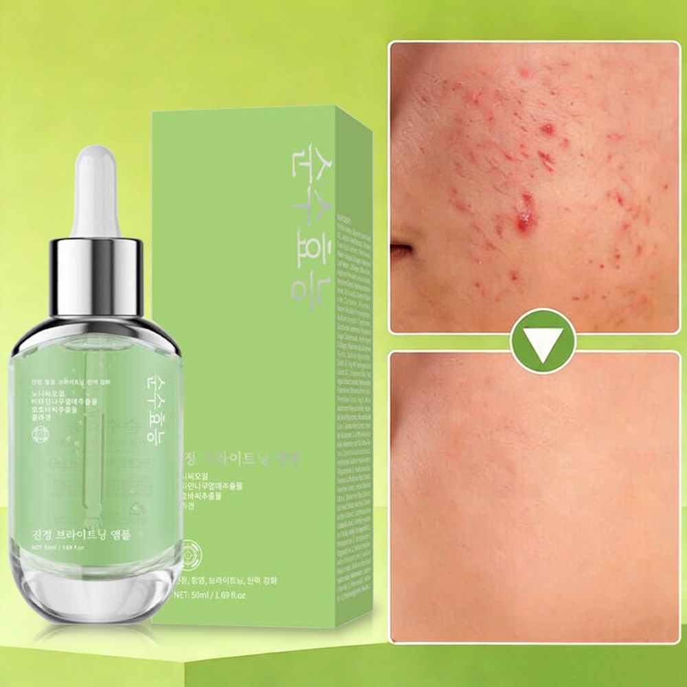 [여성 수분크림1위] 레이저 치료후 피부과 재생크림 시카 크림 여성 수분크림 재구매율1위 피부과재생크림 재생크림추천 EGF재생크림 PDRN재생크림 피디알엔 영양크림 PDRN크림, 1개, 50g 20,800원