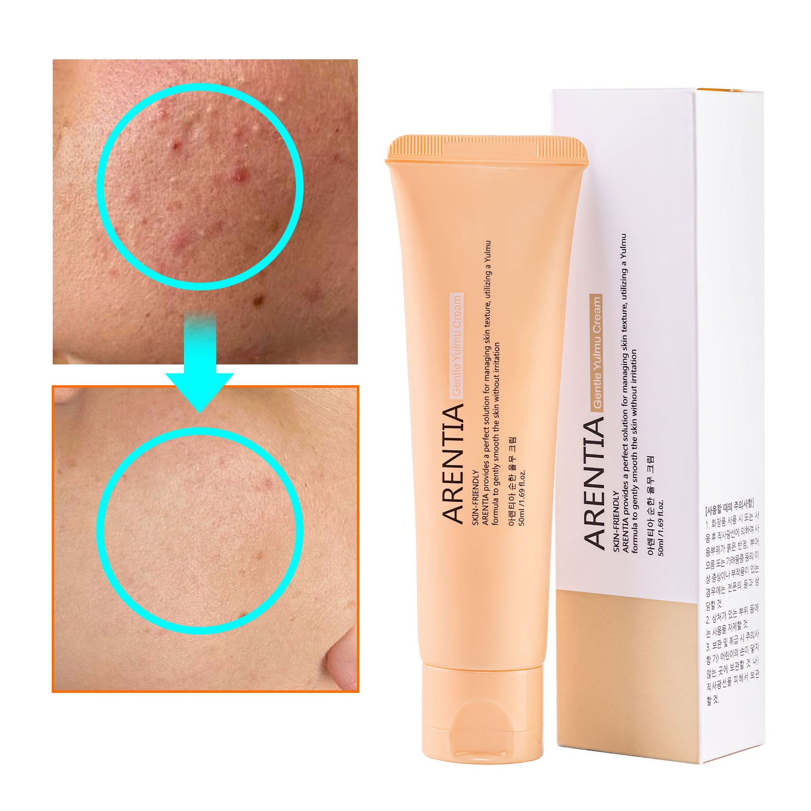 율무크림 율무 피부요철 율무영양크림 피부 오돌토돌 좁쌀 피부 요철 피부결개선 얼굴 눈밑 나비존 모공 비립종, 1개, 50ml 16,000원