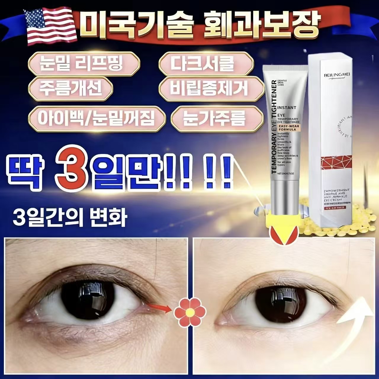 [피부과 추천] 눈밑지방 아이크림 눈밑지방제거 눈가방 아이크림 다크써클 눈밑함몰 눈가주름 개선, 3개, 20g 27,800원