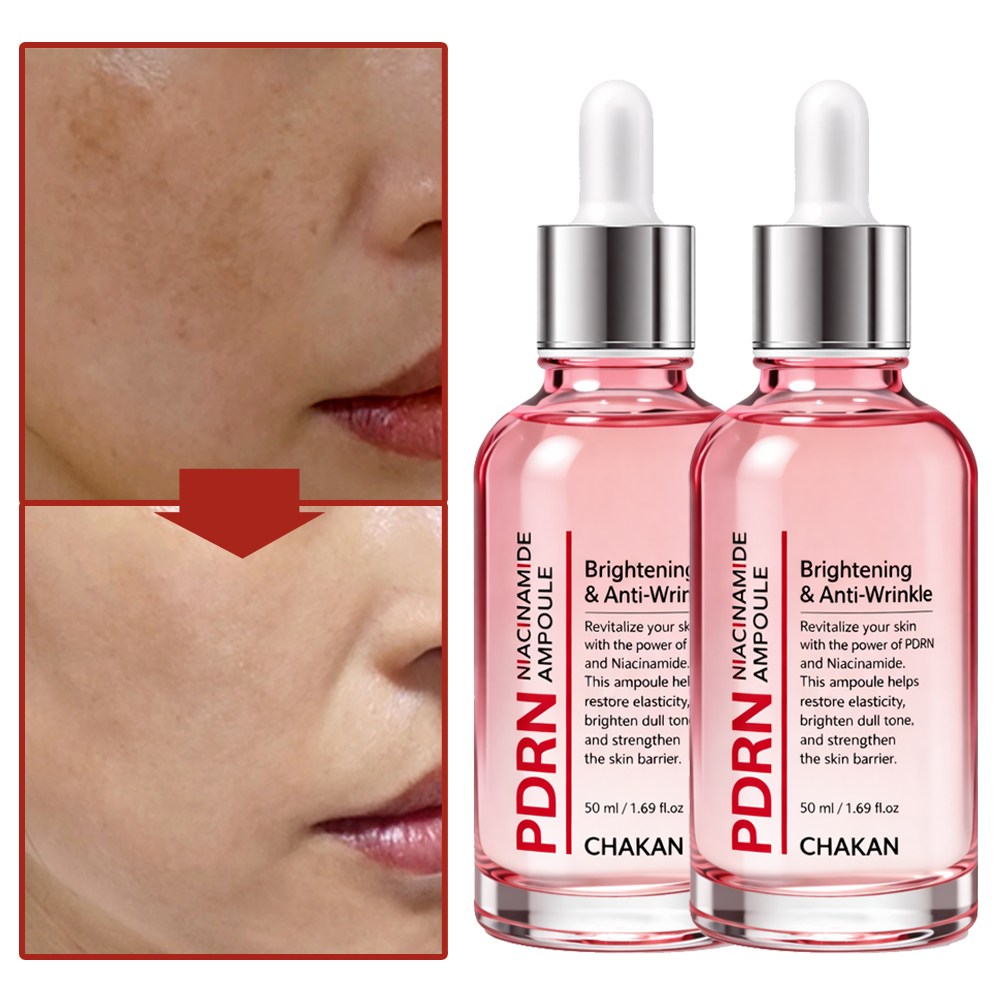 기미 잡티 주근깨 보습 모공 피디알엔 PDRN 나이아신아마이드 앰플, 2개, 50ml 37,500원
