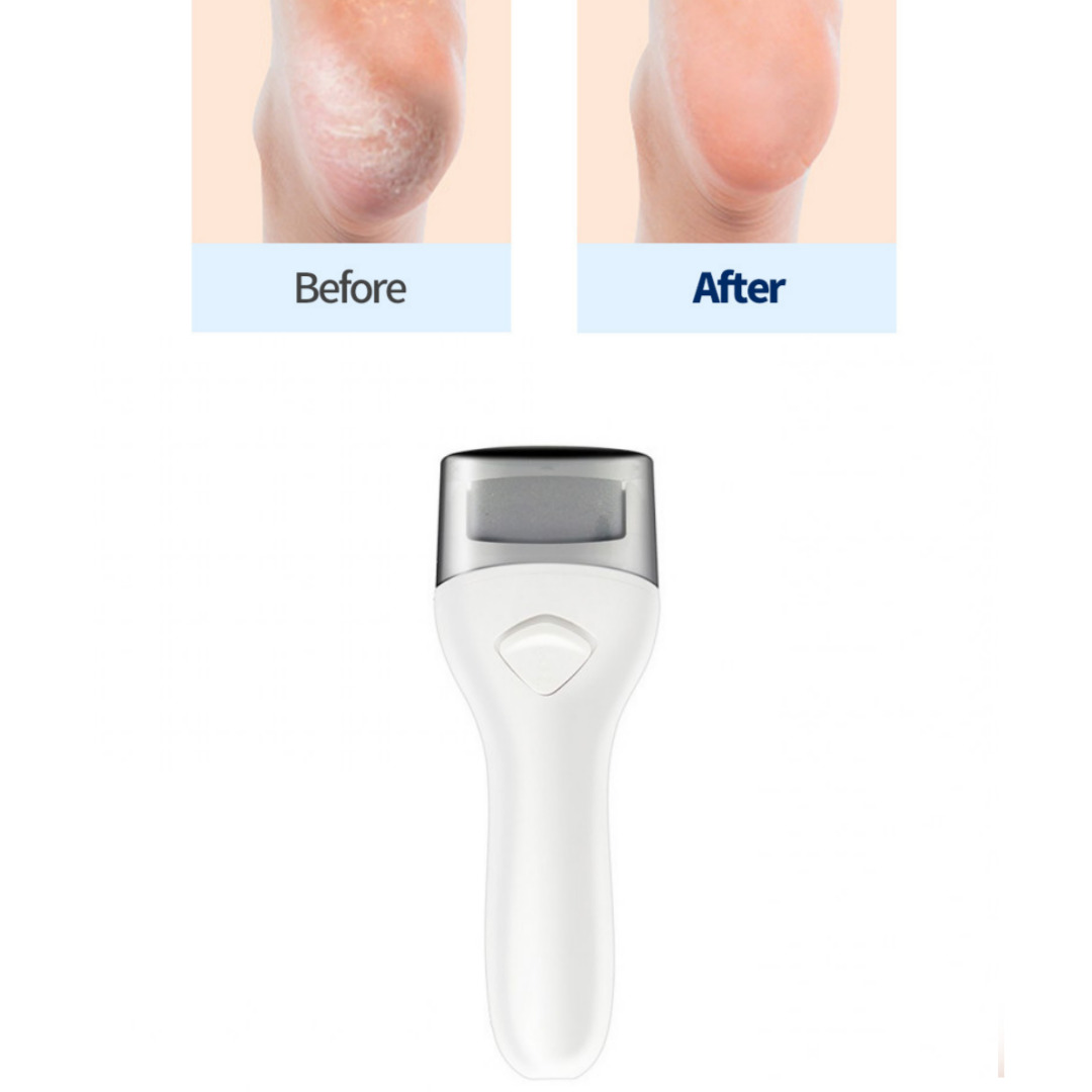 이사칠 무선전동 휴대용 충전식 발꿈치 발각질제거기 19,500원