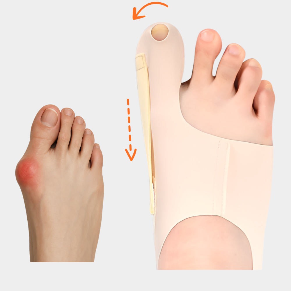 비엔즈 엄지 발가락 교정기 고정 밴드 9,900원