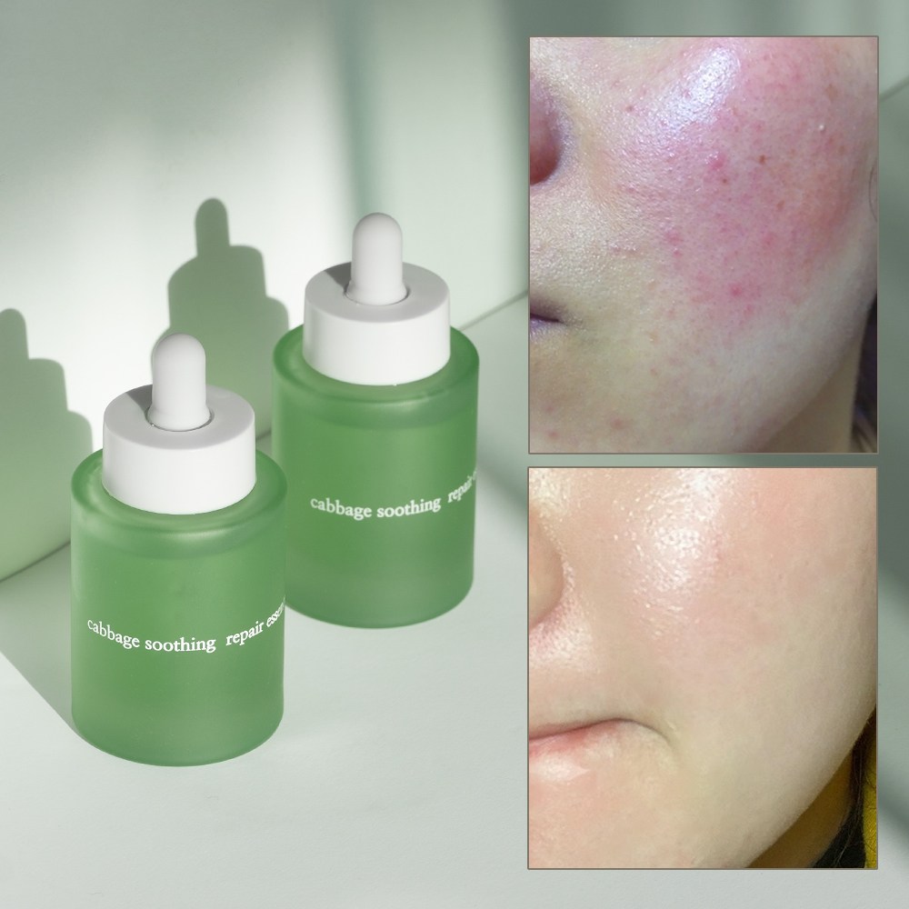 엘리메르 캐비지 수딩 리페어 세럼 에센스, 2개, 50ml 49,300원