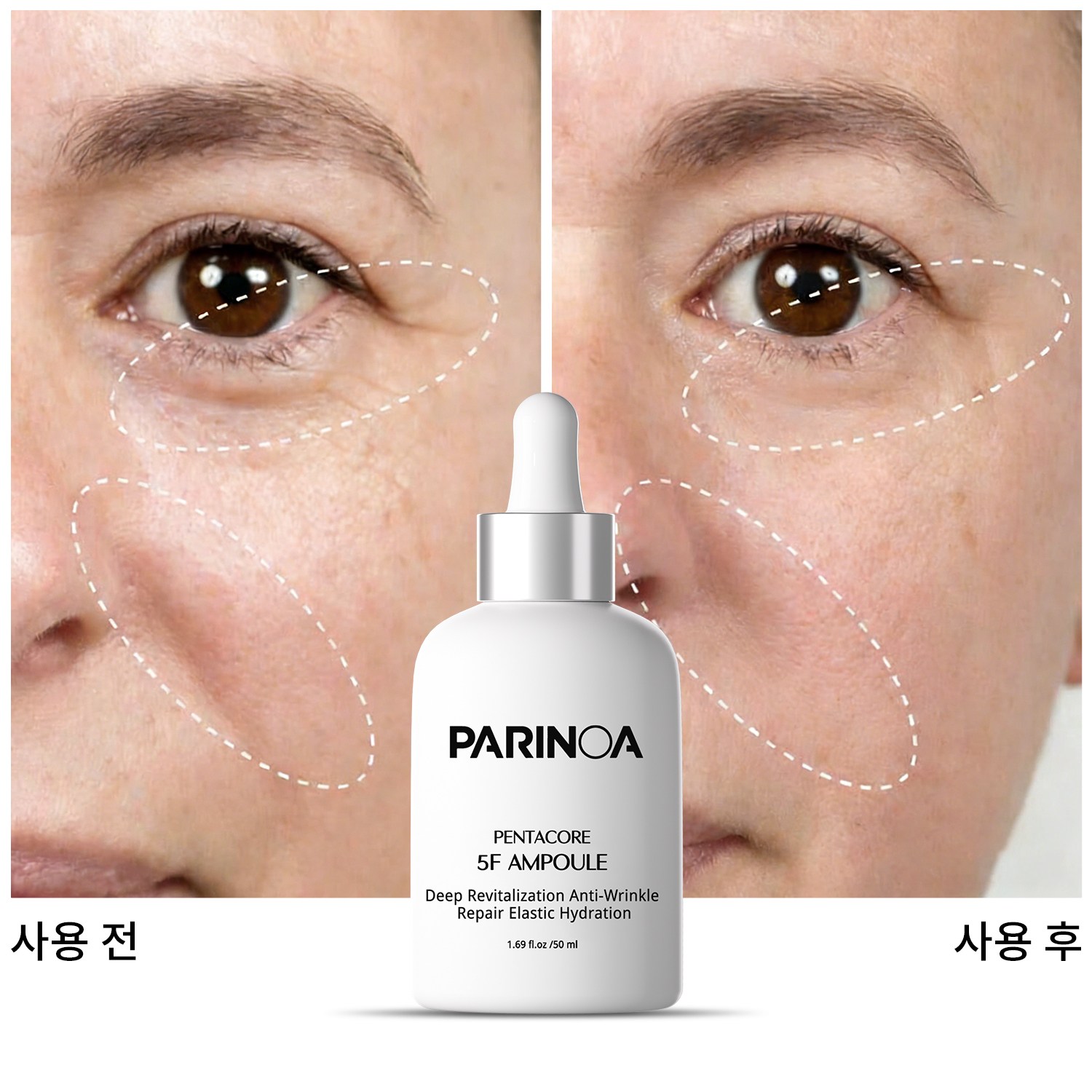 S-EGF 녹는실 리프팅 앰플 5F 리프팅 부스터 고함량 EGF 앰플 팔자주름 리프팅 PDRN 엑소좀앰플 EGF 고함량 비타민C 부스팅 앰플 콜라겐 레티놀 펩타이드 영양 미백 앰플 17,990원