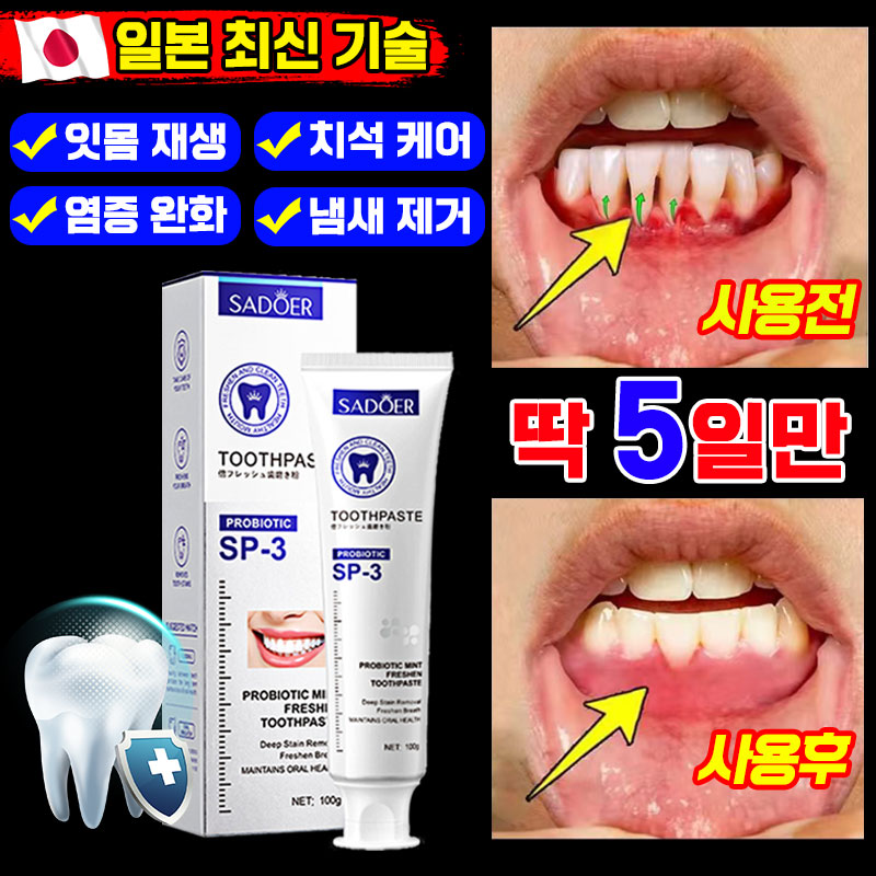 [효과 보장]잇몸 재생 치약 잇몸치약 약국 전용 잇치 치약 치주염 잇몸붓기 이빨 염증 케어 개선 예방 통증 완화 냄새 얼룩 제거 포장 증정 17,600원