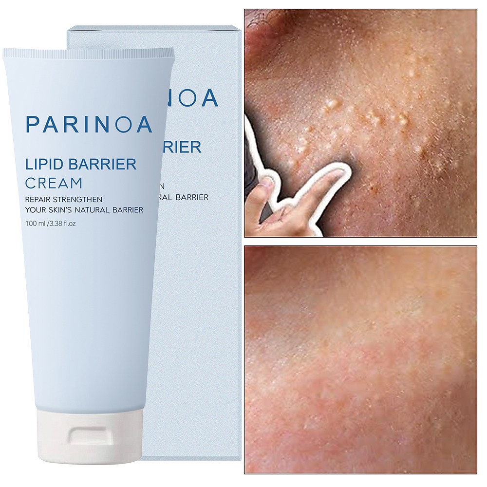 [돌기성 요철케어] 피부 요철 좁쌀 각질 제거 크림 나이아신아마이드 판테놀 세라마이드 센텔라 시카 리페어 크림 피부 장벽 케어 점빼고재생크림, 1개, 50g, 현재가 21,000원