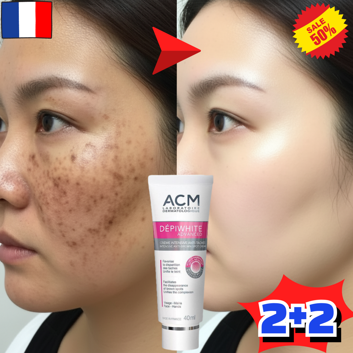 [프랑스 개발]멜라논 크림 기미 잡티 주근깨 검버섯 제거 크림 미백 크림 화이트닝 색소침착크림 25,500원