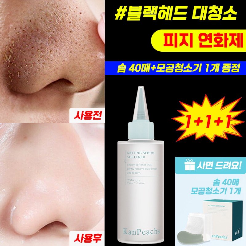 [얼굴 대청소~] 피지 연화제 블랙헤드 모공 코 피지제거 얼굴 각질제거 대용량 피지연화제 솜+모공청소기 증정 18,800원