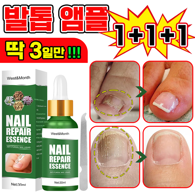 [국내배송] 발톱 거품나는앰플 솔루션 문제성발톱 앰플 발톱 곰팡이 한번에끝내는 손발톱 영양제 보장증정 20,900원
