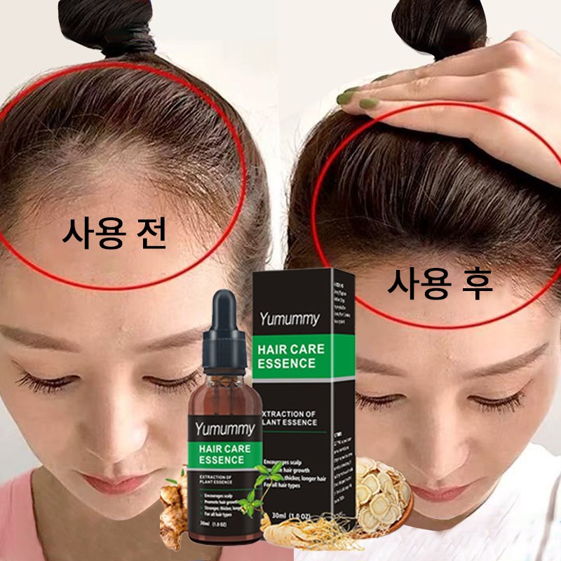 Hair Hair Grower 영 양 두 피 케 어 세 럼, 1개, 30ml 10,000원