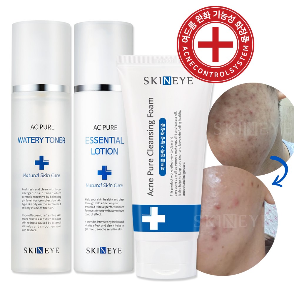 스킨아이 AC 퓨어 워터리 토너 + 에센셜 로션 아크네 청소년 여드름 클렌징 폼 SET (여드름 기초 스킨케어 3종 SET), 1세트 45,900원